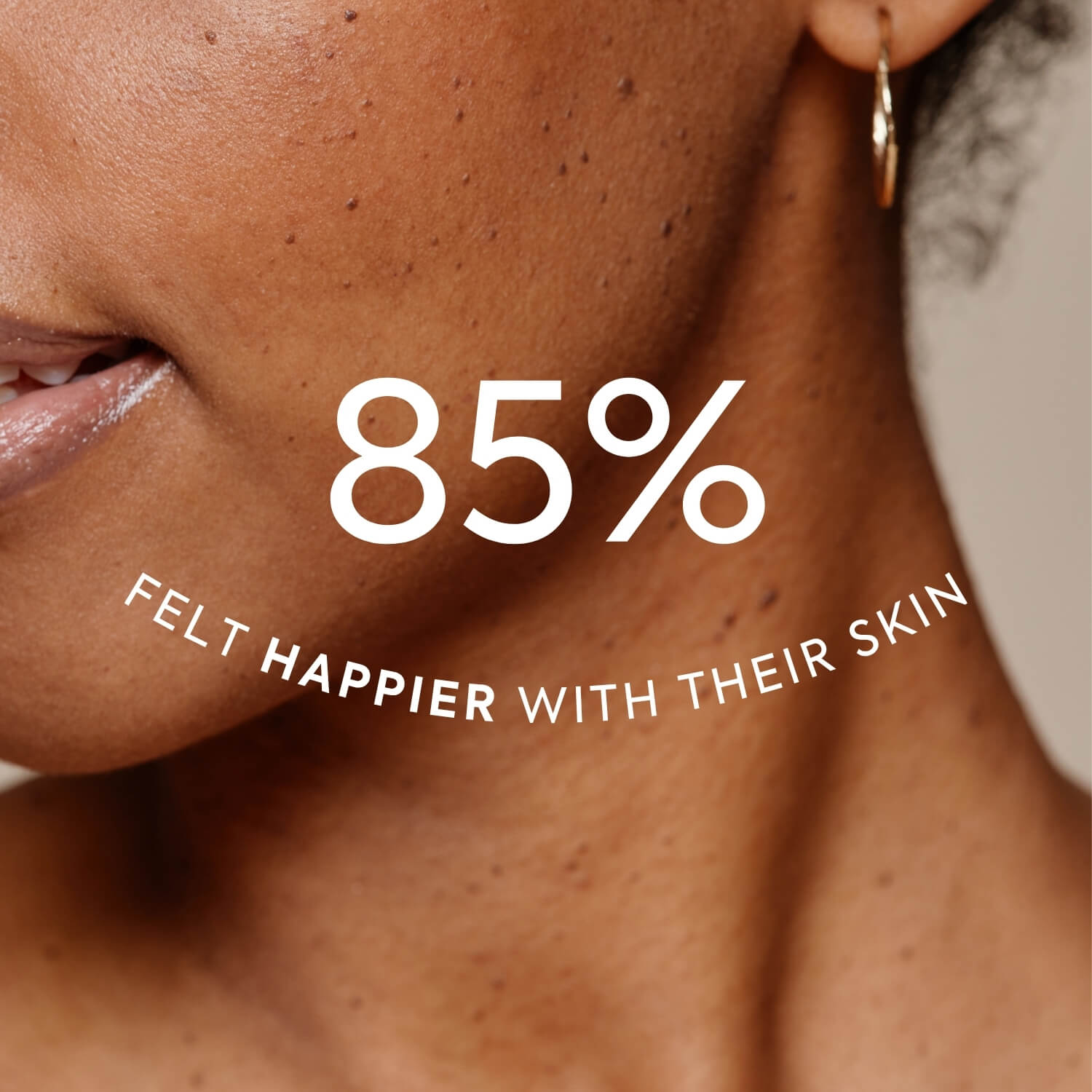 85% felt happier with their skin after taking Efamol Evening Primrose Oil capsules