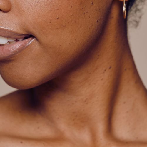 Efamol skin health blog collection